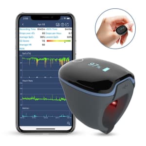 Wellue O2Ring Finger Oxygen Monitor for $105
