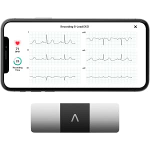 KardiaMobile 6-Lead Personal EKG Monitor for $98