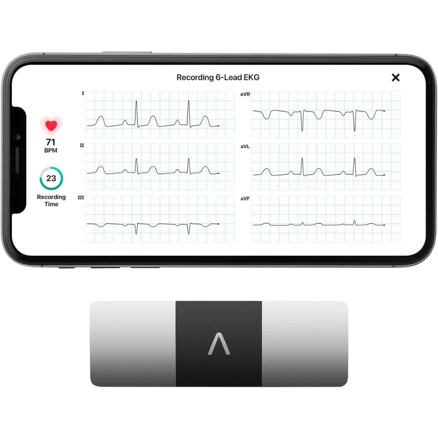 KardiaMobile 6-Lead Personal EKG Monitor: $119