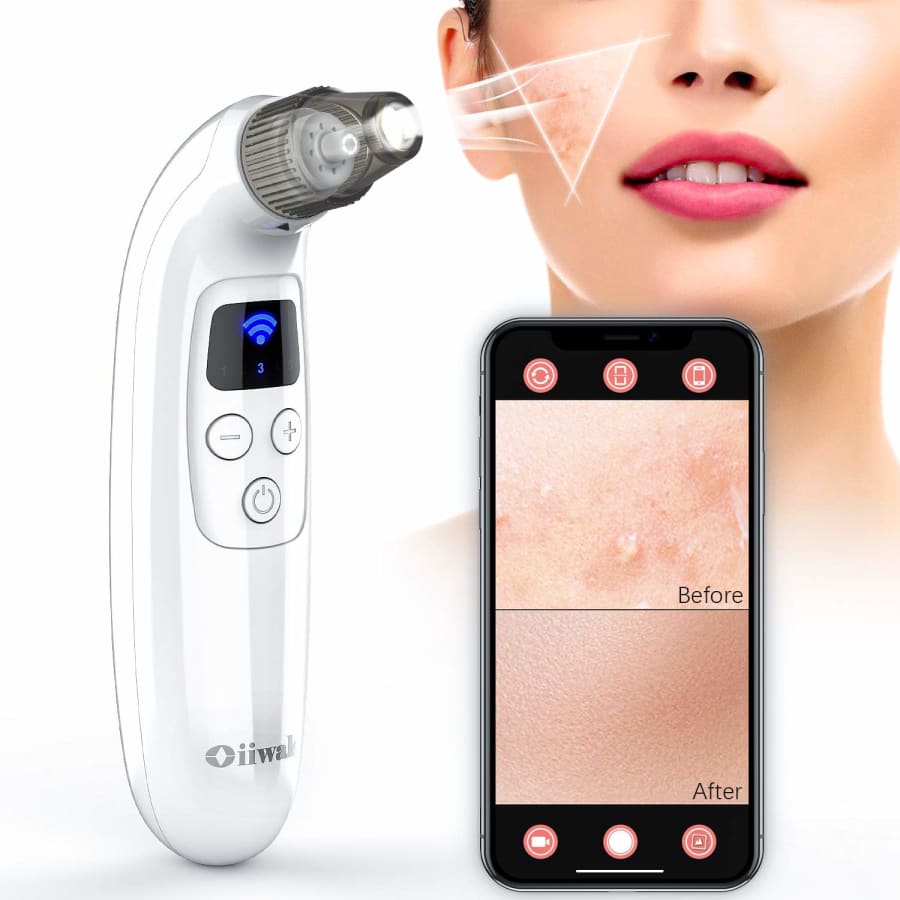 Oiiwak Pore Vacuum with Camera for $48 Oiiwak Pore Vacuum with Camera for $48